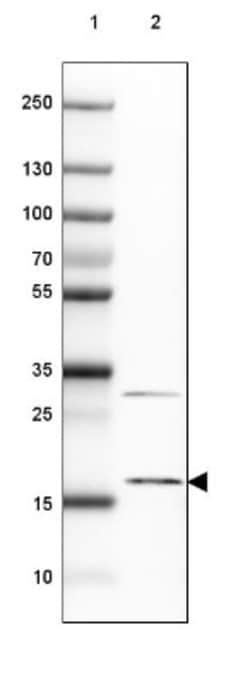 SNRNP25 Antibody, Novus Biologicals 0.1mL; Unlabeled:Antibodies, Polyclonal